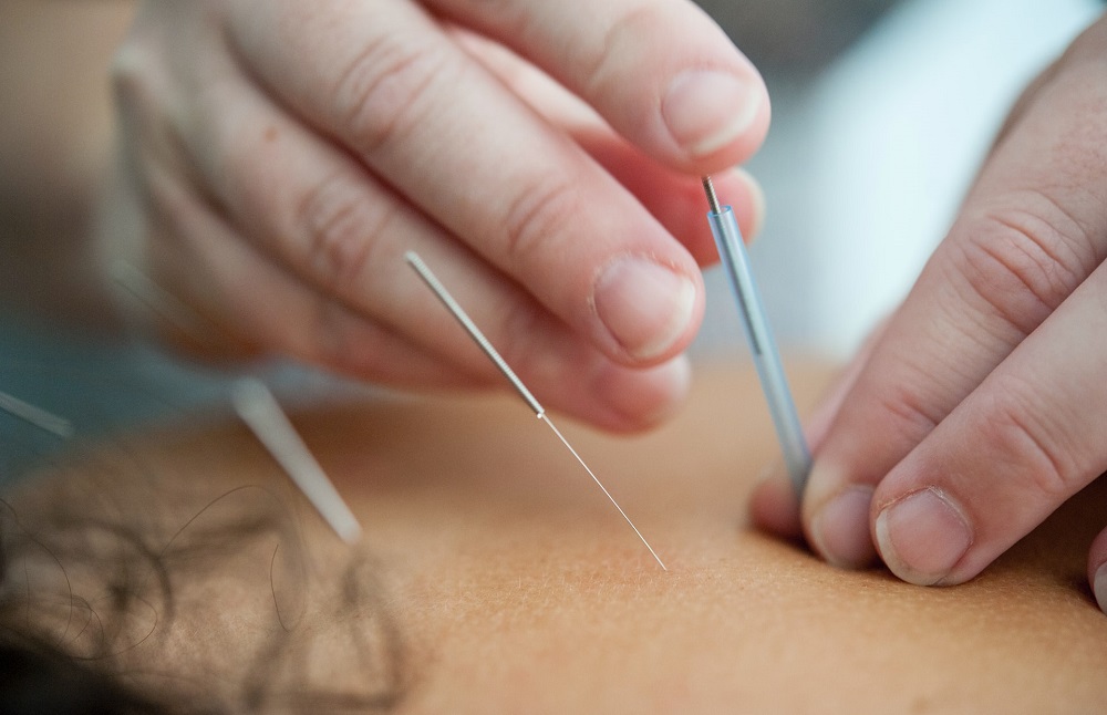 Dry Needling Dripping Springs, TX
